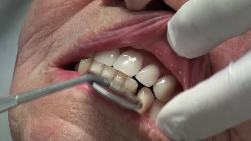 A Dissertation On Artificial Teeth Evincing The Advantages Of Teeth Made Of Mineral Paste