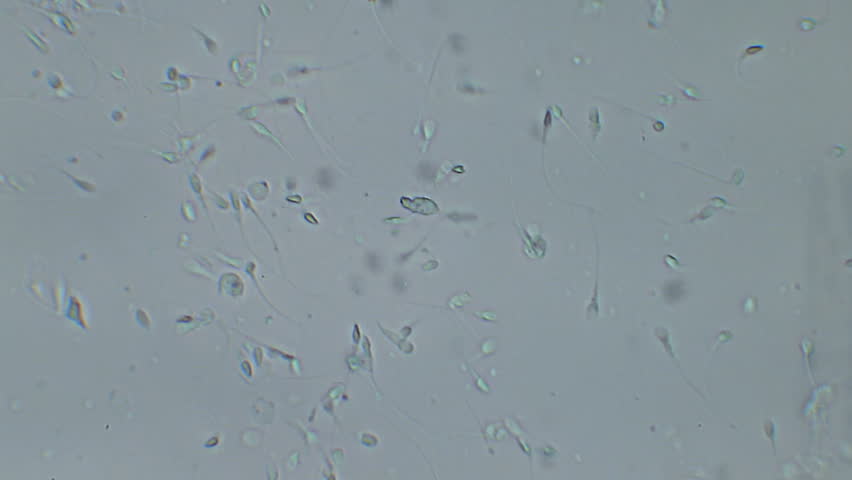 Best of Sperm cells 400x 400x Sperm cells