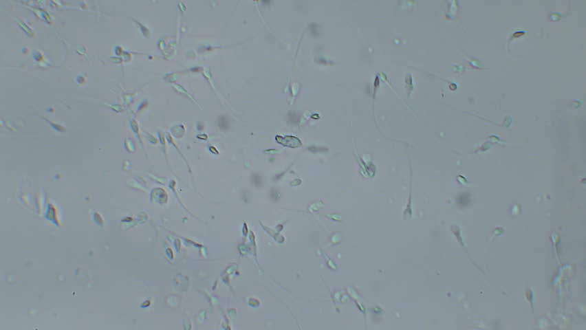 400x Sperm cells
