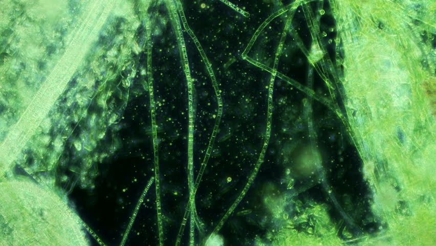 Water Algae Lab Sample 400x (HD). Microscopic Algae Seen ...